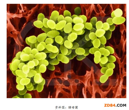 ���ތW���ý�ĸ���l(f��)���Ʒ��b���� �|(zh��)�ؽӽ�Ƥ�w